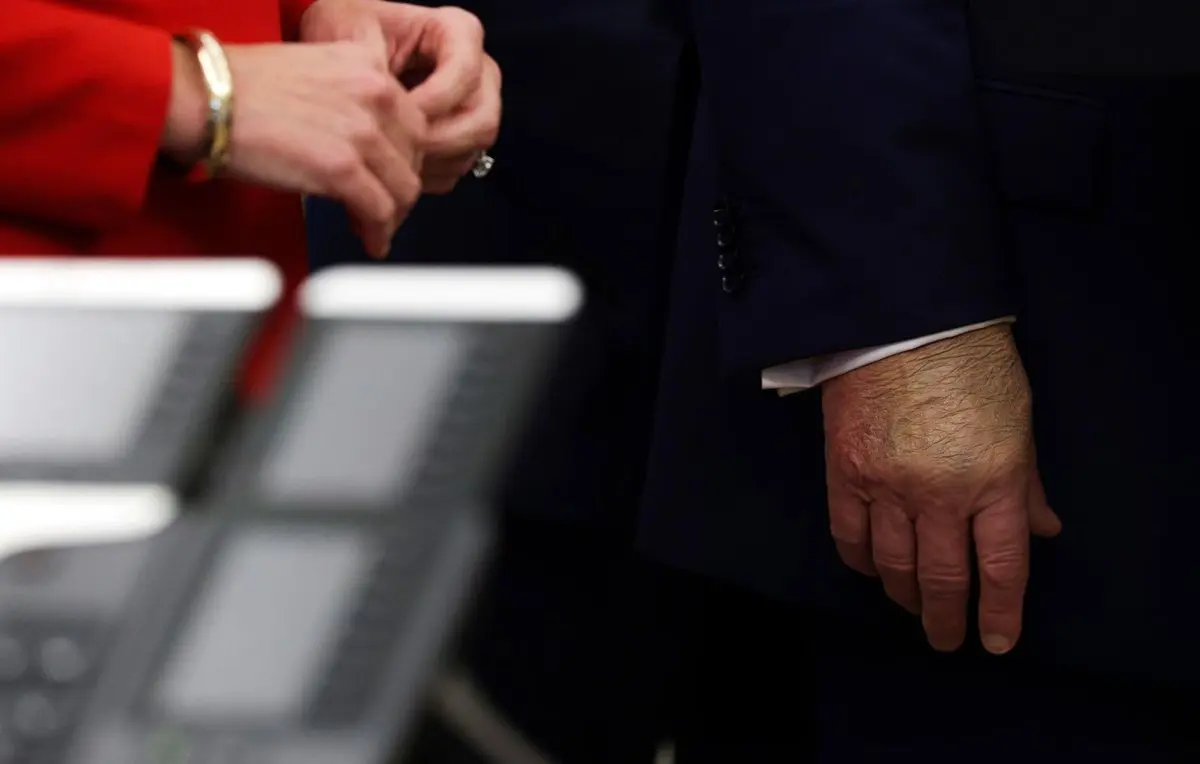 دو چسب زخم روی دست ترامپ ؛ تشدید بیماری ؟