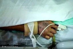 نکاتی که در صورت ابتلا به کرونا باید جدی بگیرید