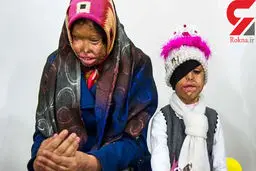 اسیدپاشی پدر کرمانی بی رحم روی همسر و 2 دخترش / این فیلم اشک تان را درمی آورد