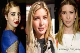 چهره کاملا متفاوت ایوانکا ترامپ قبل از جراحی زیبایی بینی! عکس