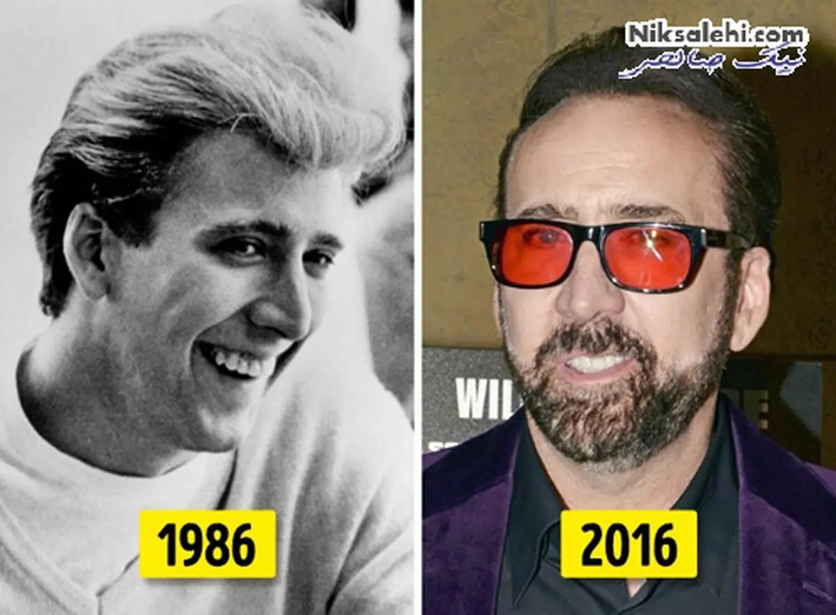 تغییر چهره عجیب و باور نکردنی نیکلاس کیج