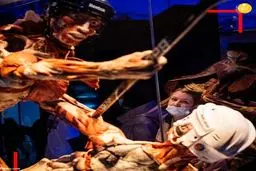 تصاویر خفن از نمایشگاه جنجالی «دنیای بدن»