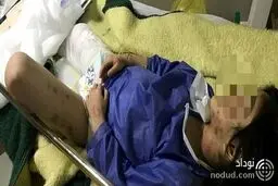 شکنجه دختر 6 ساله مهابادی با آب داغ و ضرب و شتم شدید او ! + عکس 12+