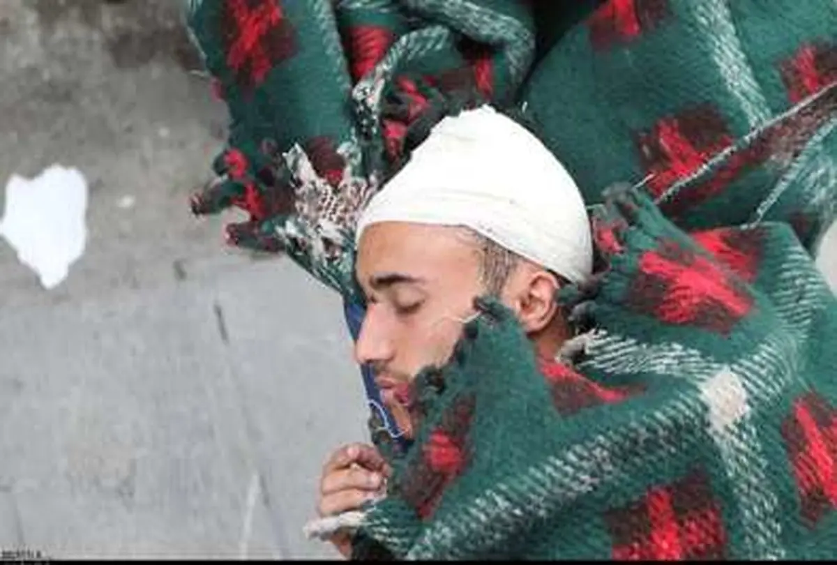 تصاویری از درمان زخمی های حملات تروریستی یمن در تهران