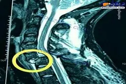 تصویری هولناک از شکستگی گردن بازیکن استقلال!
