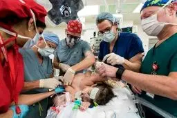 پیچیده‌ترین جراحی جداسازی دوقلوها/تصاویر