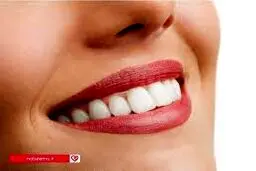 با شرکت در کمپین دکتر داوودیان لبخند زیبا داشته باشید