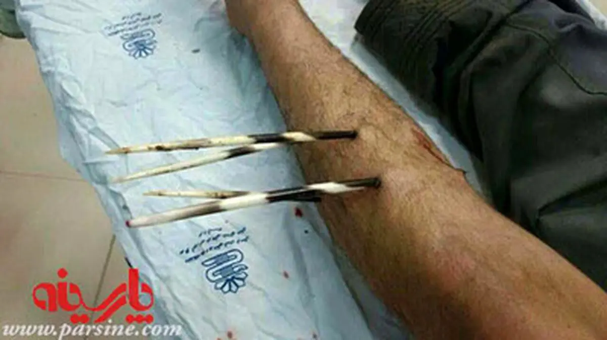 حمله جوجه‌تیغی به کشاورز لرستانی/تصاوير