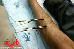 حمله جوجه‌تیغی به کشاورز لرستانی/تصاوير