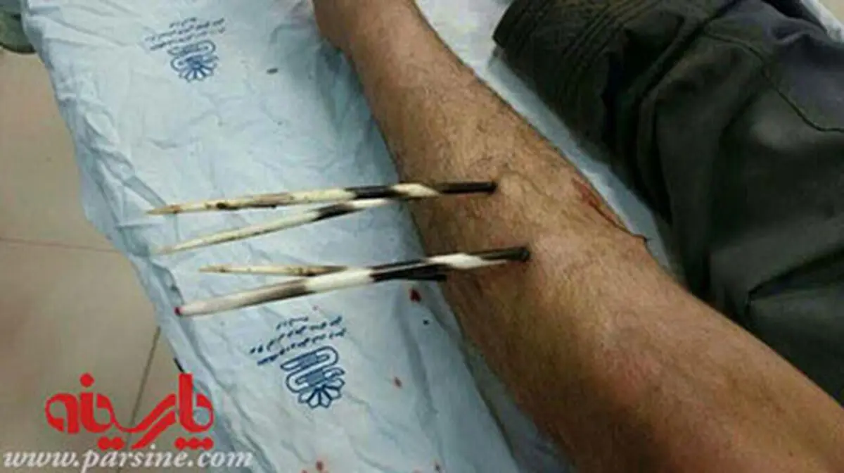 حمله جوجه‌تیغی به کشاورز لرستانی/تصاوير