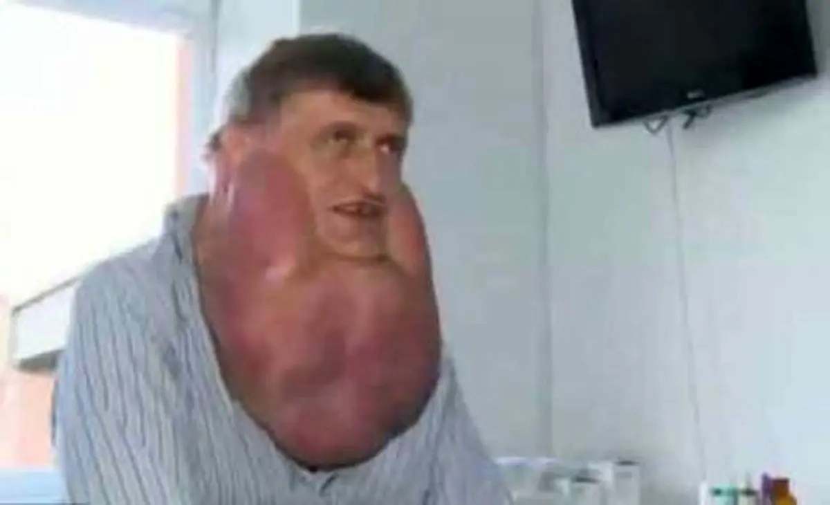 مردی عجیب با گردنبندی از گوشت+عکس