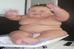 نوزادی با غیر طبیعی ترین رشد وزن+عکس