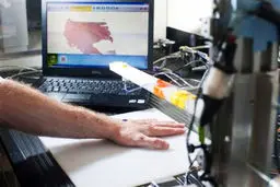 درمان سوختگی با پرینت پوست!/عکس