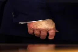 هشدار پزشک آمریکایی دربارهٔ بیماری وخیم ترامپ
