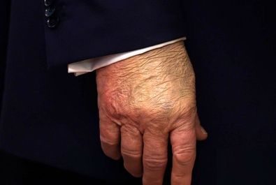 ترامپ