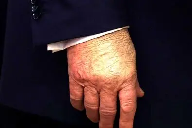 ترامپ