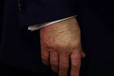 ترامپ