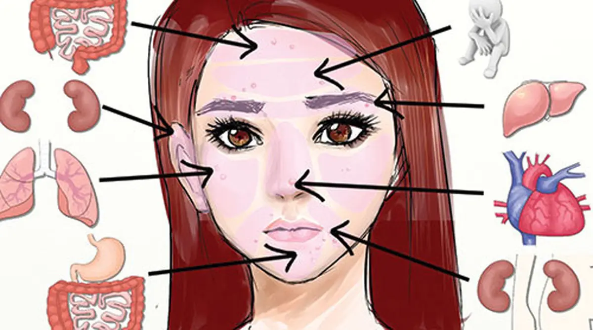 جوش‌درمانی به سبک چینی‌ها