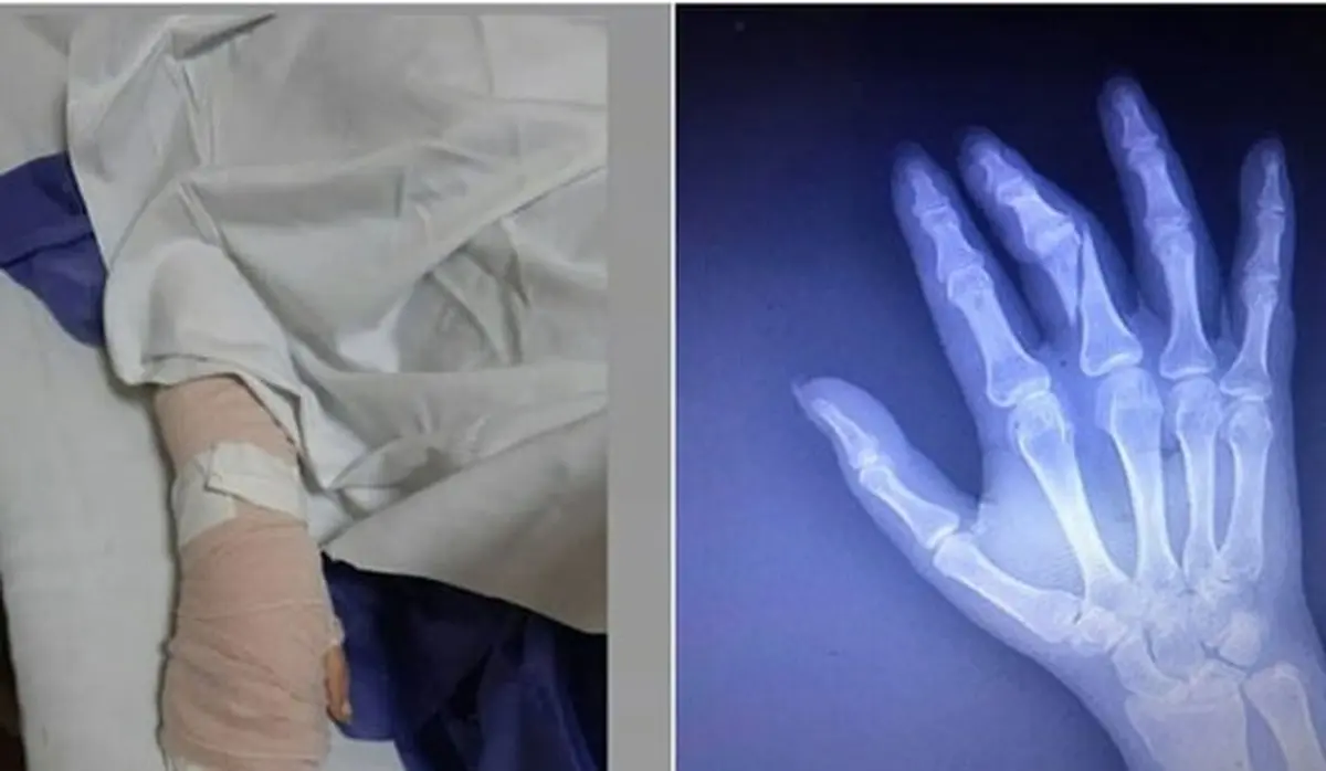  تعلیق فرد حمله کننده به خبرنگار!+جزئیات بیشتر 