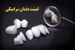 قیمت لمینت سرامیکی