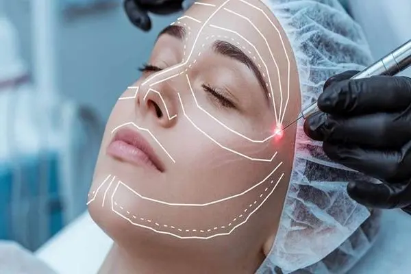 جراحی لیفت صورت یا اندولیفت؟ کدام یک سرمایه گذاری اقتصادی تری است؟