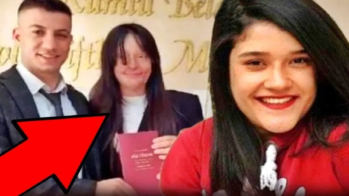  ازدواج دختر ترکیه ای با پسری که روی صورت او اسید ریخت!