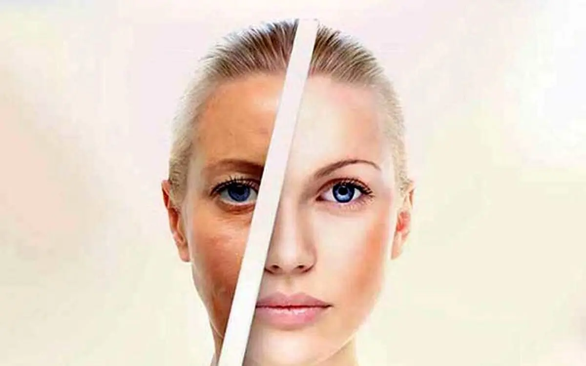 راز زنانی که در ۵۰ سالگی، پوست ۲۵ ساله دارند