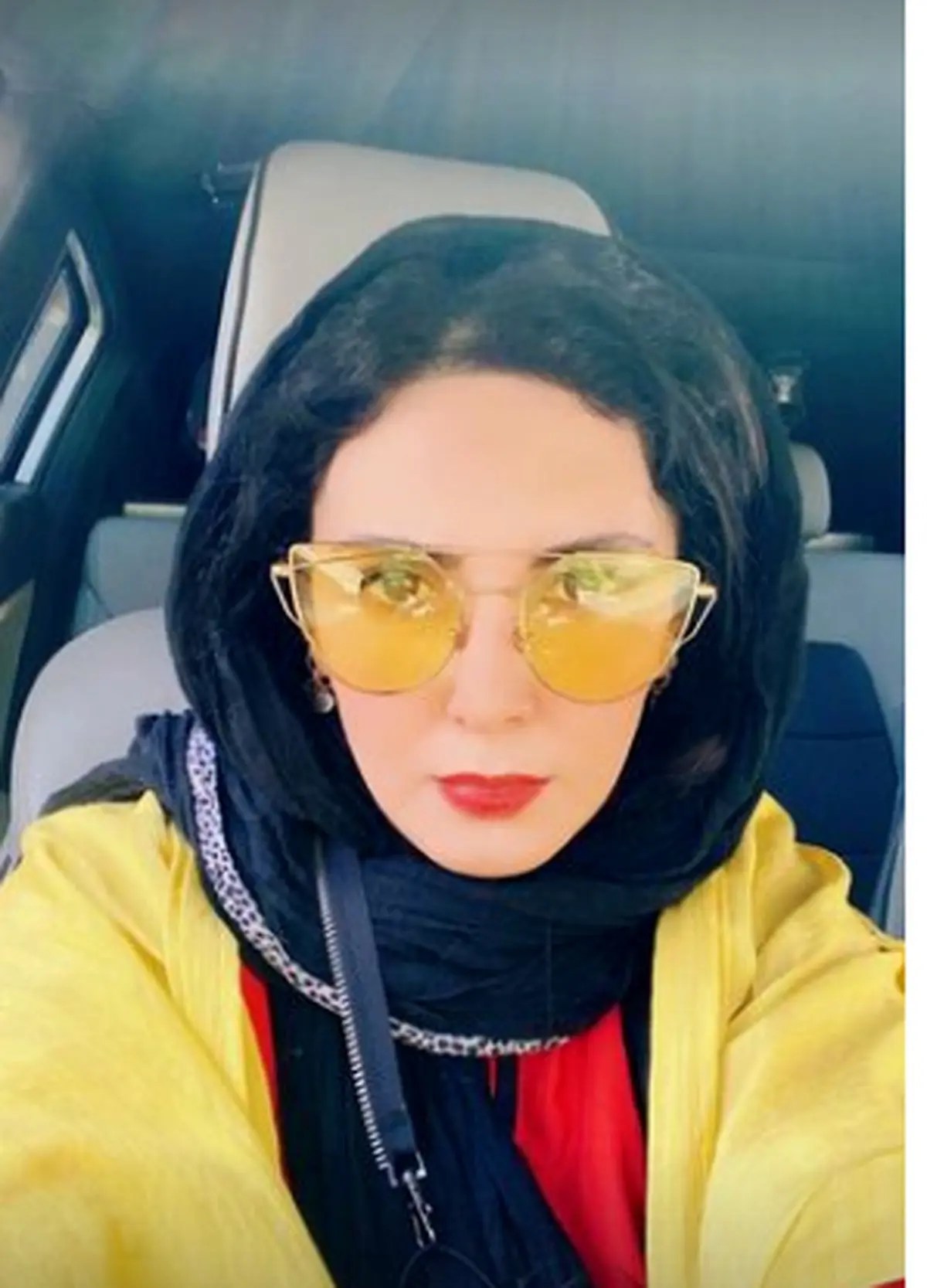 لاغری عجیب لیلا بلوکات+عکس