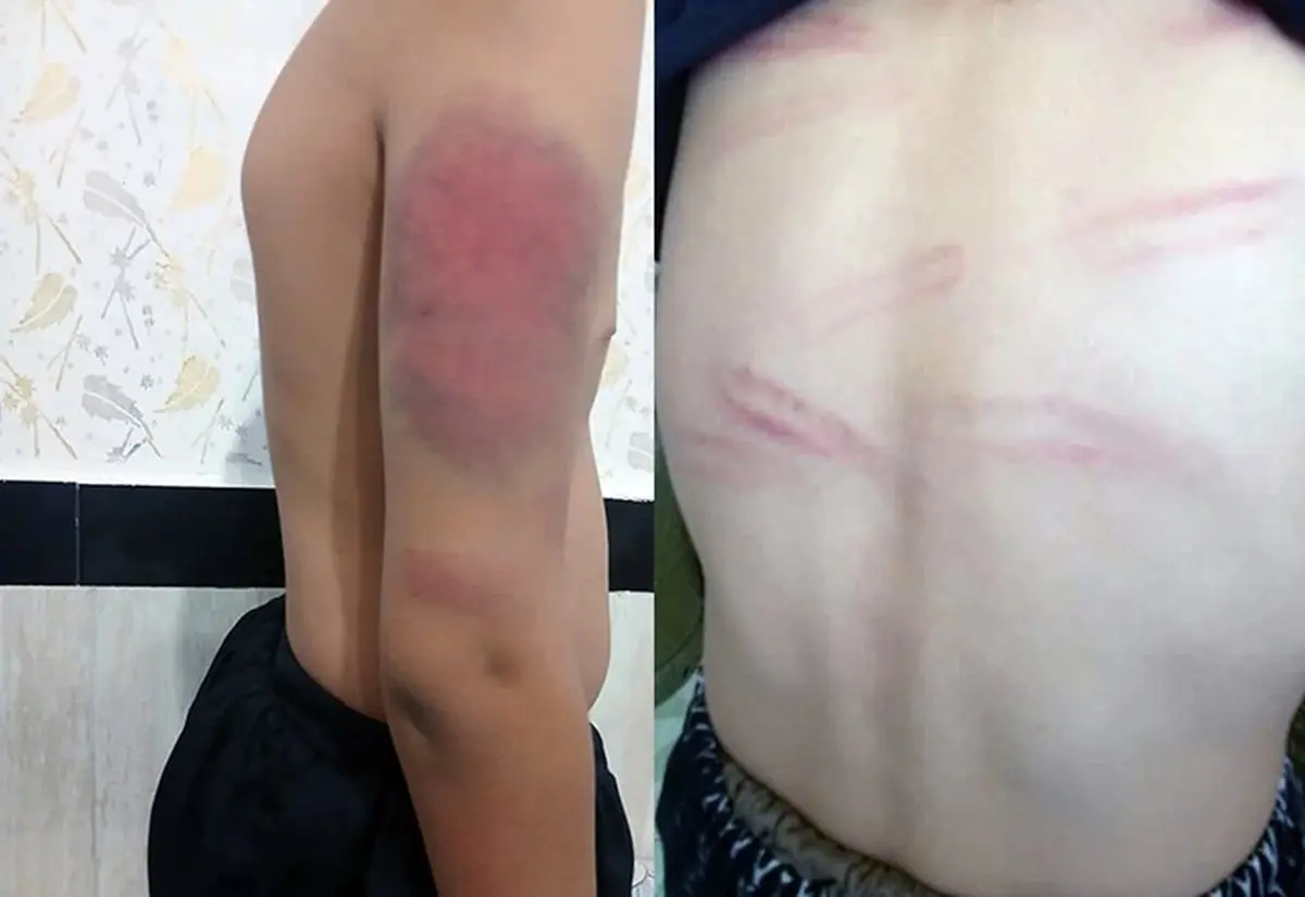 اخراج معلمی که دانش‌آموزان را با کابل تنبیه بدنی کرده بود!