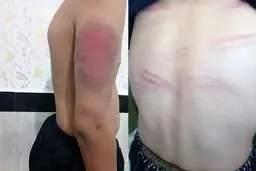 اخراج معلمی که دانش‌آموزان را با کابل تنبیه بدنی کرده بود!