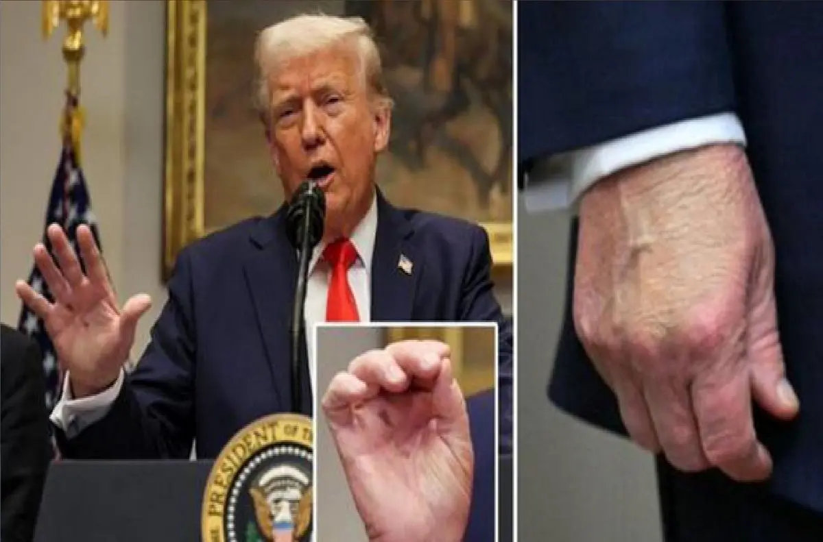 اولین واکنش ترامپ درباره سلامتی‌اش + عکس