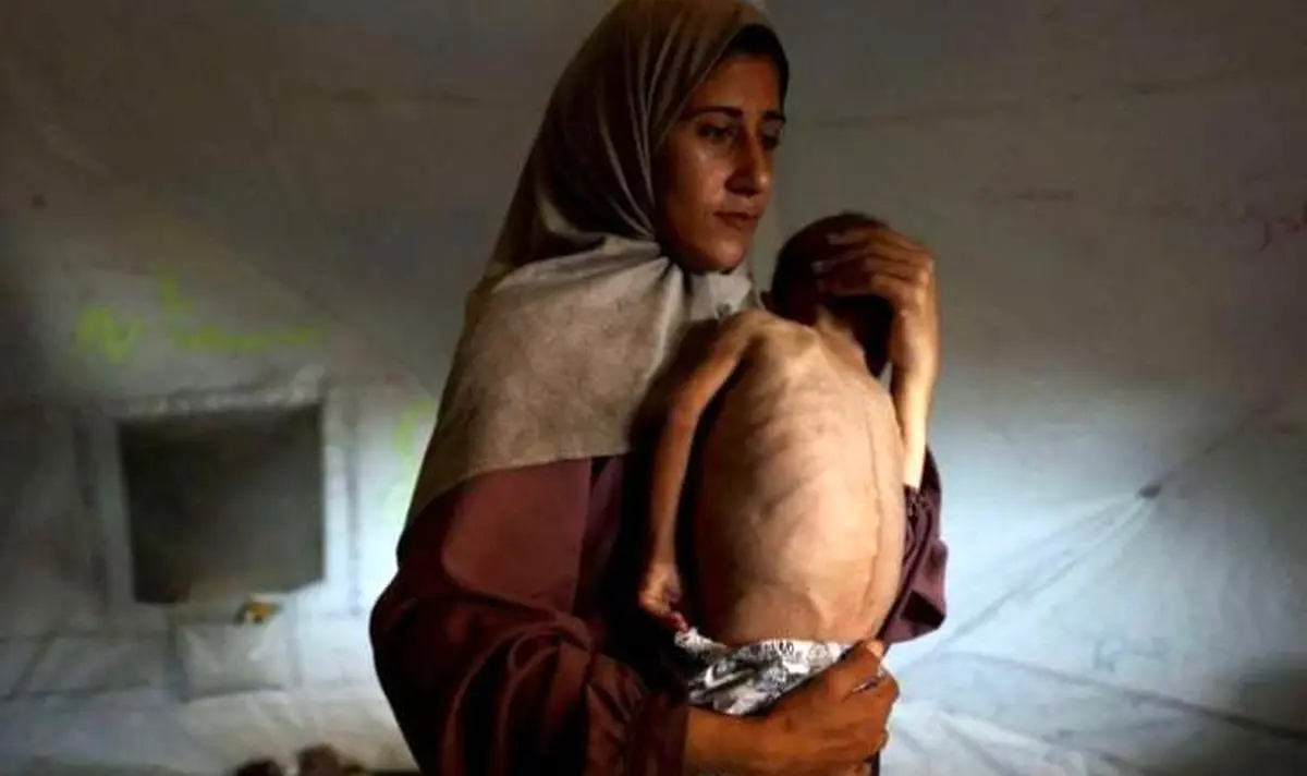 اعتراف تلخ سازمان ملل: قحطی در غزه عامدانه است
