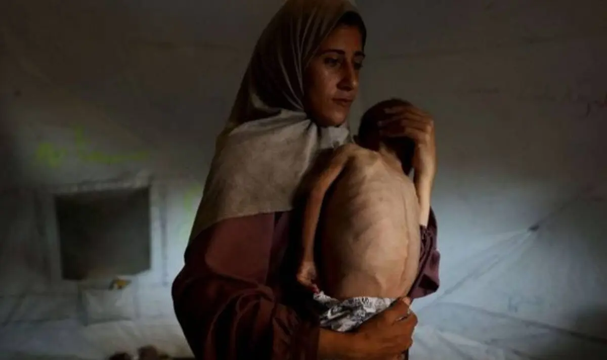 اعتراف تلخ سازمان ملل: قحطی در غزه عامدانه است