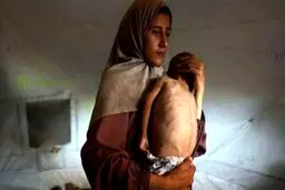 اعتراف تلخ سازمان ملل: قحطی در غزه عامدانه است