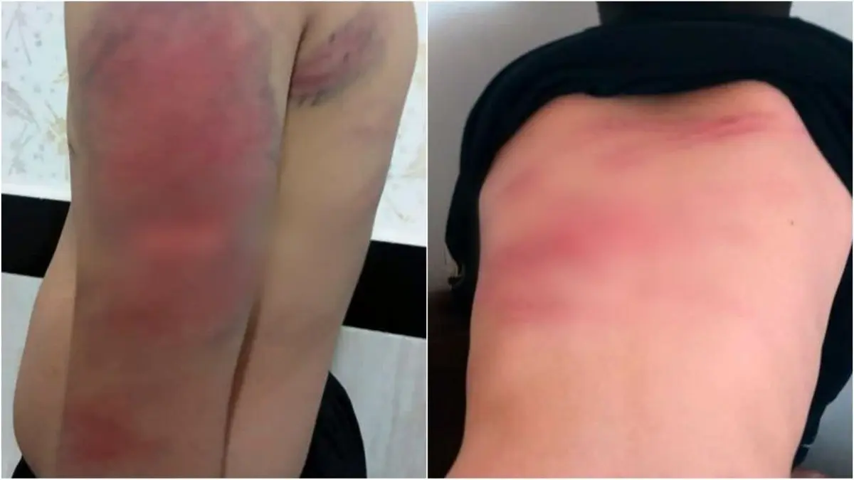 احضار معلم شکنجه‌گر 