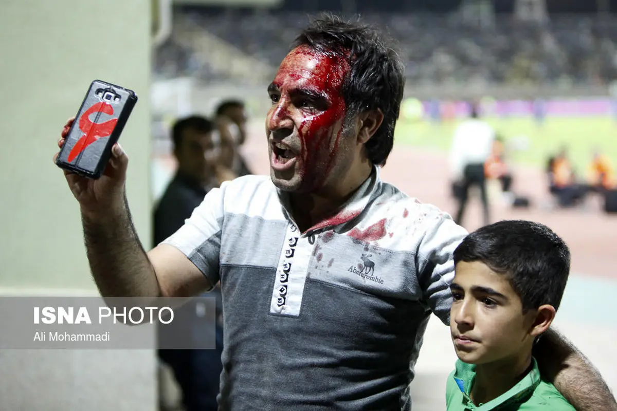 کری‌خوانی هوادار پرسپولیس با سر شکسته!/عکس