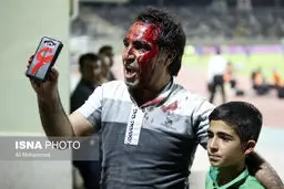 کری‌خوانی هوادار پرسپولیس با سر شکسته!/عکس