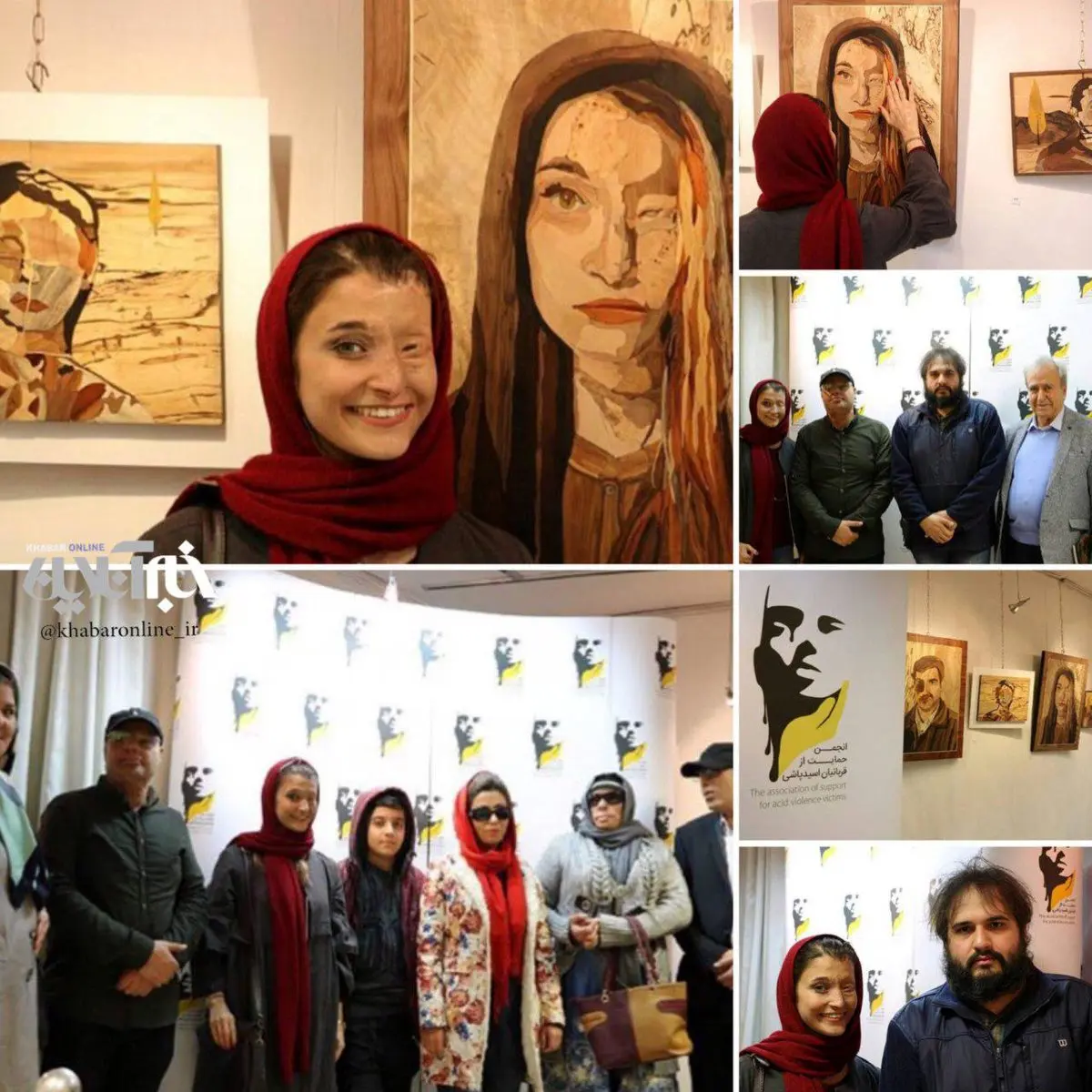 مرضيه ابراهيمى، قربانى اسيدپاشی كنار پرتره‌اش/عکس