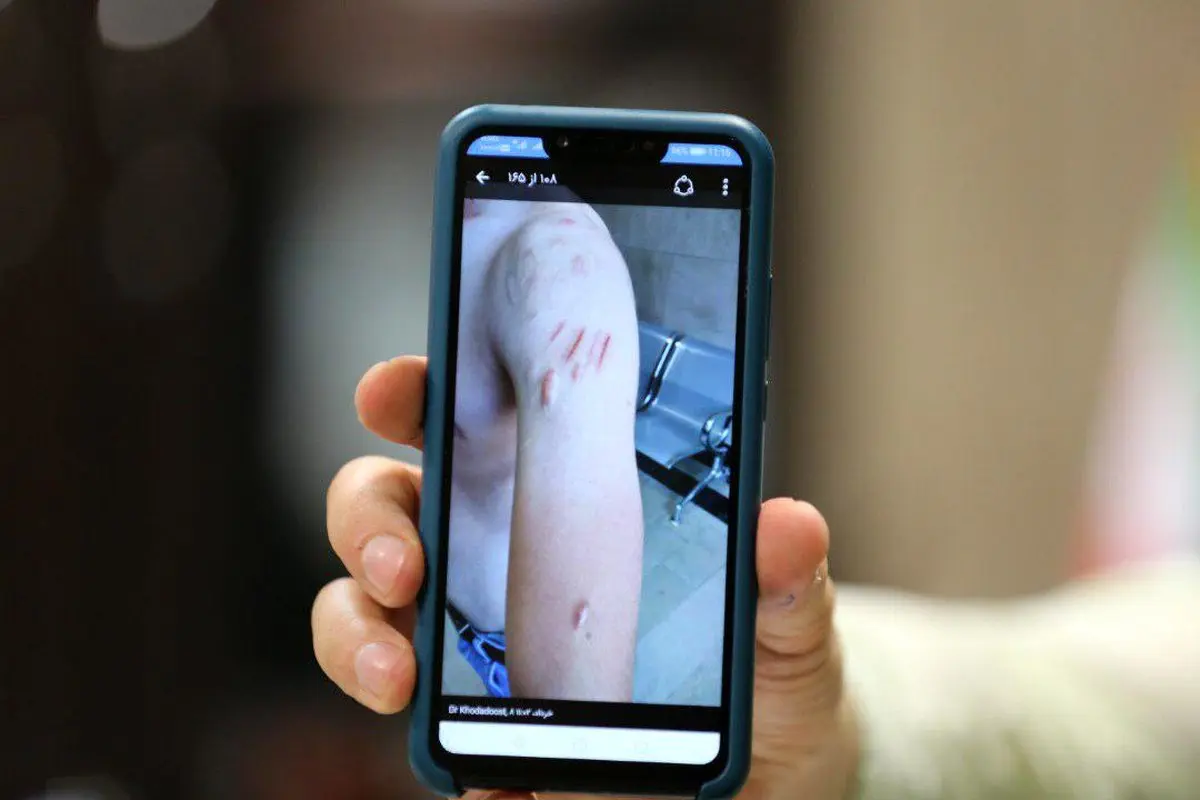 خالکوبی مانع صدور گواهینامه می‌شود؟ / چه بیماری‌های روحی مانع دریافت گواهینامه می‌شوند؟