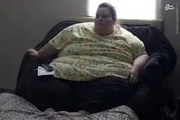 دختر 321 کیلوگرمی بعد از عمل جراحی/ عکس