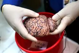 تصاویر / بانکی برای نگهداری مغز انسان‌ها!