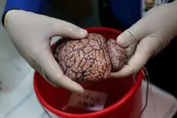 تصاویر / بانکی برای نگهداری مغز انسان‌ها!
