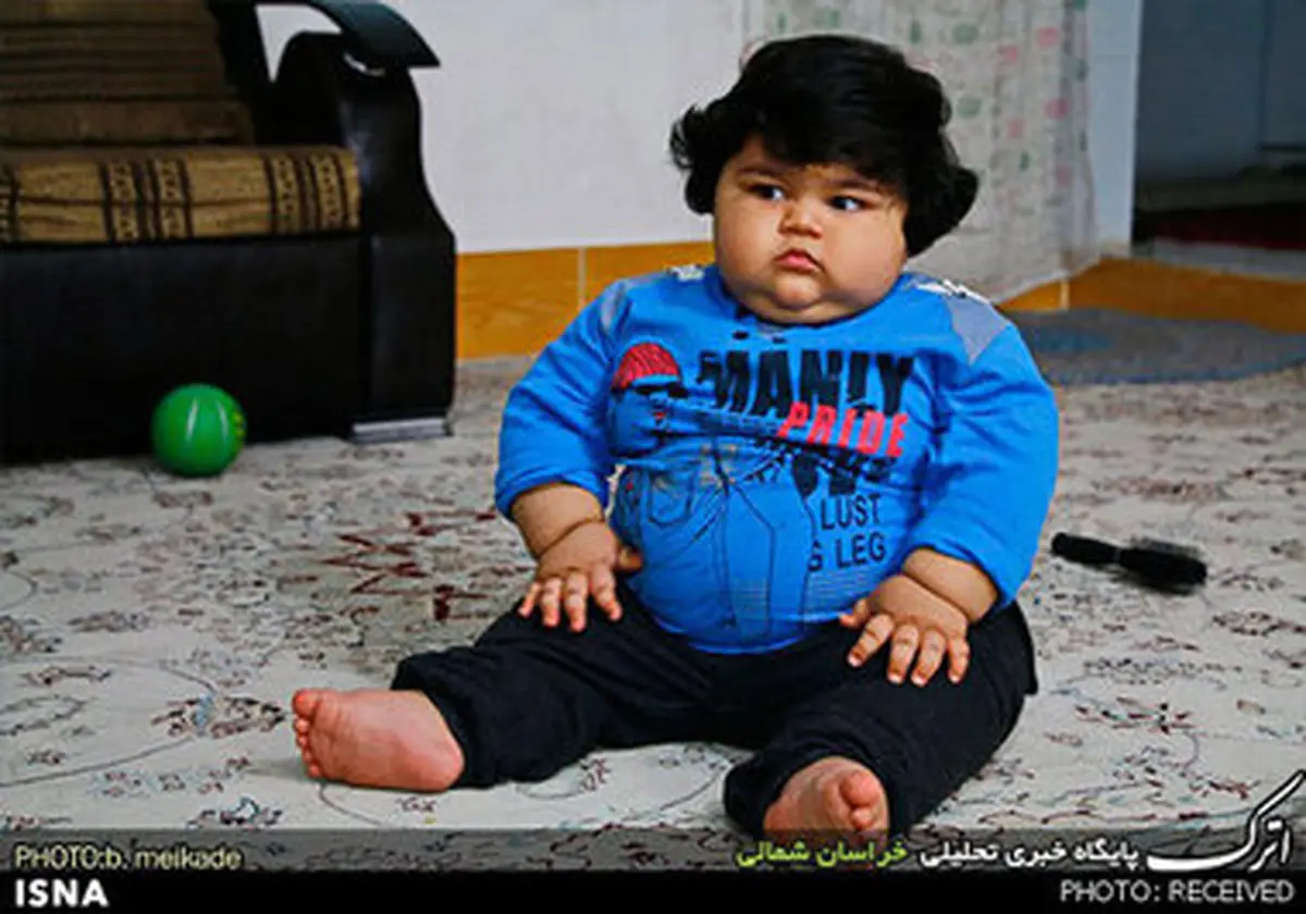 کودک 15 ماهه 42 کیلویی ، همیشه گرسنه است/تصاویر