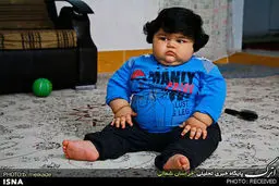 کودک 15 ماهه 42 کیلویی ، همیشه گرسنه است/تصاویر