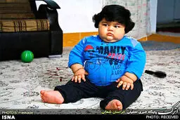 کودک 15 ماهه 42 کیلویی ، همیشه گرسنه است/تصاویر