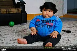 کودک 15 ماهه 42 کیلویی ، همیشه گرسنه است/تصاویر