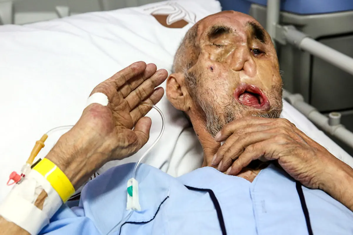 اسطوره جانبازی ایران‌ به شهادت رسید+ عکس