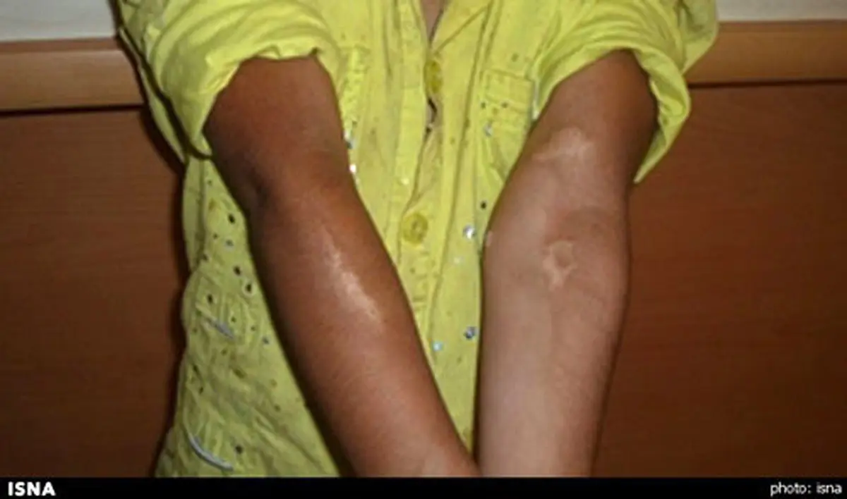 بهزیستی، ستایش را از پدر و مادرش گرفت! +عکس