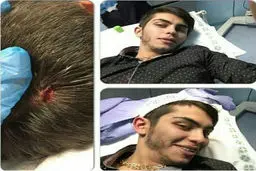 تصویری از شکسته شدن سر ارسلان قاسمی