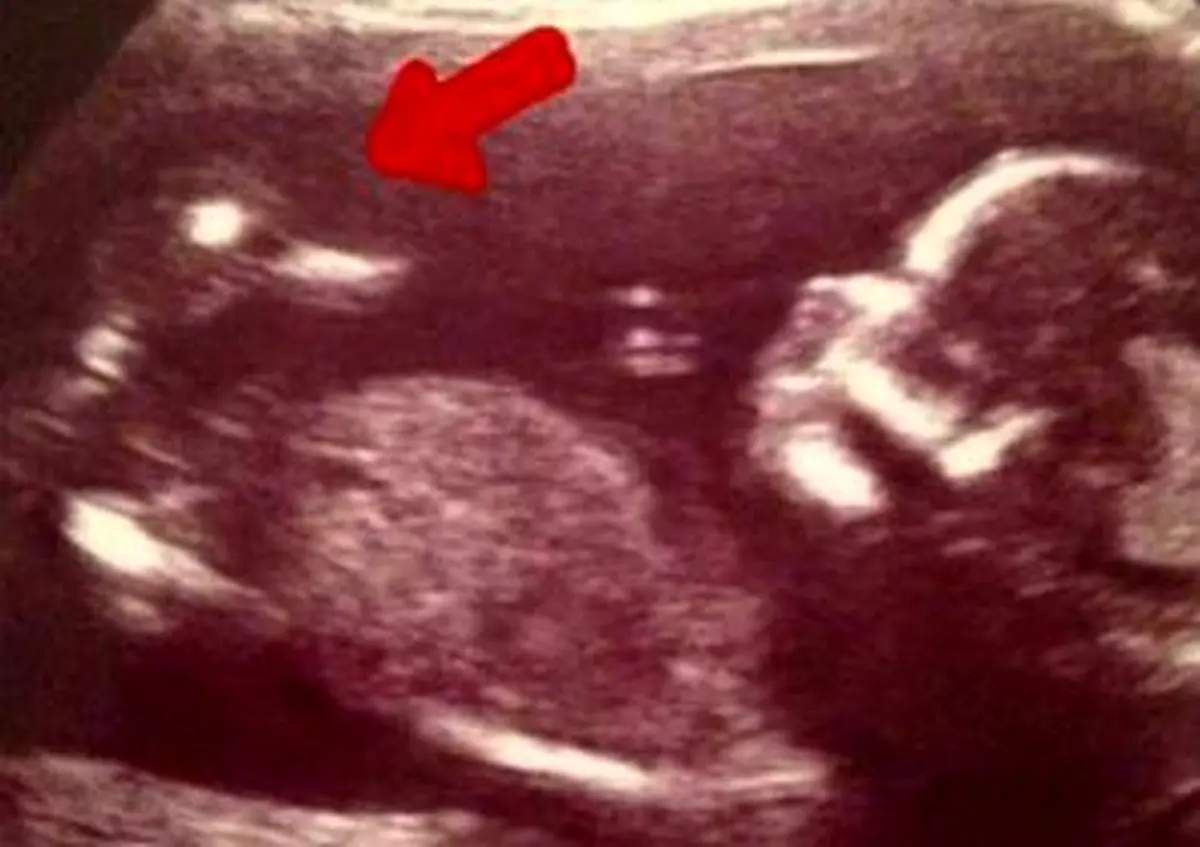 خبر شگفت انگیز/ این زن یک اردک را باردار است!+ عکس